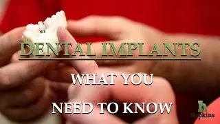 Implants - the closest option to your natural teeth.