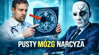 🎭 NARCYZ To Biologiczny INWALIDA EMOCJONALNY 🧠 Wyjaśnię Ci, dlaczego!