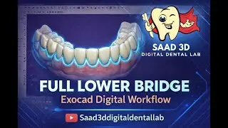 Full Lower Bridge Design in Exocad | Complete Digital Workflow | Dental CAD CAM