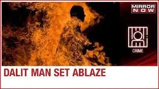 Dalit man set ablaze & succumbs to his injuries; CM expresses condolences