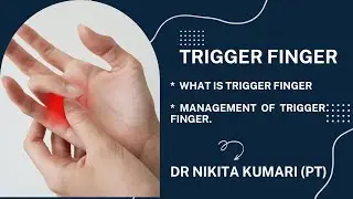 Trigger finger / stenosing tenosynovitis - it's management. DR NIKITA PT CENTRE,KOSLI 9817748680