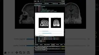 Pydicom y python. #aprenderpython #python #pydicom