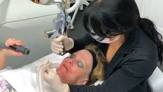 CONTOURTRL