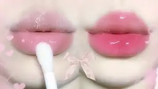 Lip filler💉🎀