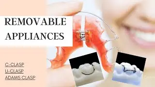 REMOVABLE APPLIANCES || C-CLASP || U-CLASP || ADAMS CLASP  #orthodontics