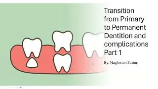 Transition from Primary to Permanent Dentition and complications Part 1