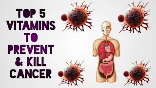 TOP 5 VITAMINS PREVENT & KILL CANCER