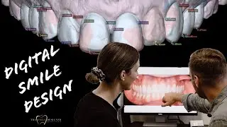 Digital Smile Design