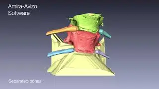 Bones separation with Amira Software