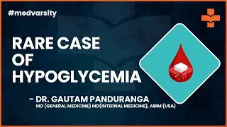 Hypoglycemia: Rare Case Discussion | @MedvarsityTechnologiesPvtLtd
