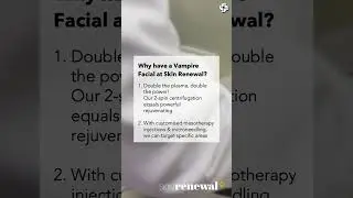 WHY HAVE A VAMPIRE FACIAL AT SKIN RENEWAL - #skinrenewalsa #skincare #skinresurfacing #antiaging