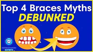Top 4 Braces Myths Debunked