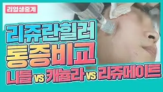 리쥬란을 통증없이?😎니들 vs 캐뉼라 vs 리쥬메이트 통증, 엠보싱 비교[리얼시술영상]
