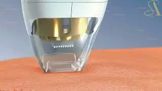 SA-RV04 New titanium gold thermal energy lattice skin repair system