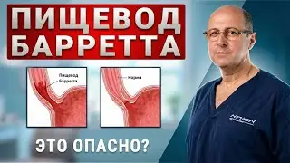 Пищевод Барретта: метаплазия, дисплазия и профилактика | доктор Юрий Гольдес