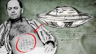 He Was Burned by a UFO. In 1967, Falcon Lake Became Famous Overnight