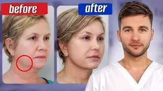 Say Goodbye to SAGGING CHEEKS in Just 10 MINUTES! /How to EASILY Lift them WITHOUT DIETS OR SURGERY?