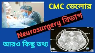 Information About Neurosurgery Dept Of CMC Vellore Part 2 | CMC Vellore Hospital | W For Wellness