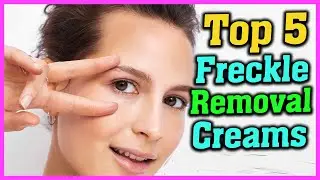 Top 5 Best Freckle Removal Creams 2021