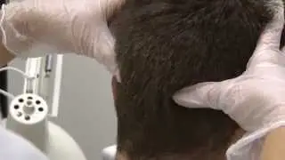 Tratamientos capilares: Masaje capilar