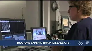Expert explains the effects of CTE