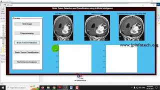 Brain Tumor Detection and Classification Using Artificial Intelligence | MATLAB Final Year Project
