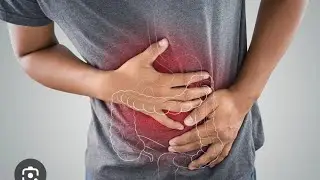 how we can prevent colon cancer- vedic perspective