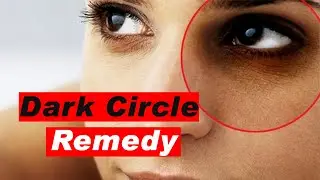 Remove Dark Circles Permanently in 1 Week (Best Home Remedy) | Ibex Media House