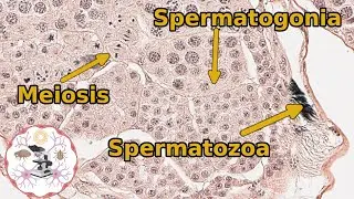 Insect (Grasshopper) Testes - Histology and Anatomy
