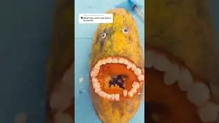 Will he survive the discount dentist? 😭