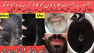 Gray coverage 😱 How to make natural black hair dye permanent black hair 100 % Result