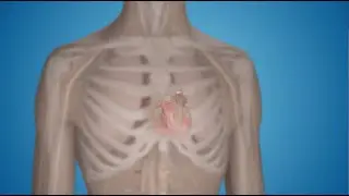 What Is a Pacemaker and How Does It Work?