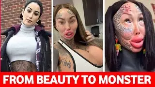 12 Most SHOCKING Plastic Surgery Transformations