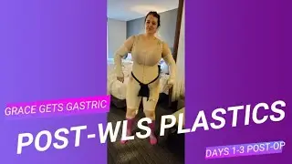 * Plastics VLOG Days 1-3 * Arm Lift & Thigh Lift * Plastics after WLS * Plastics in Mexico *