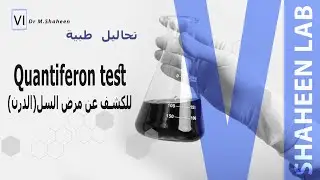 Quantiferon test (QFT) تحليل