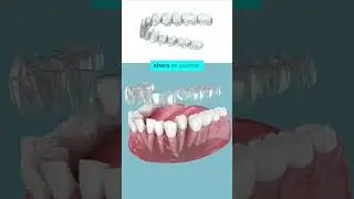 &iquest;Quieres tu nueva sonrisa en menos tiempo? 😁✨
