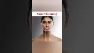 Dermdoc Kojic night cream review in tamil #glowingskin