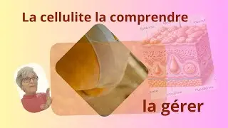 Comment g&eacute;rer la cellulite : solutions naturelles et avanc&eacute;e