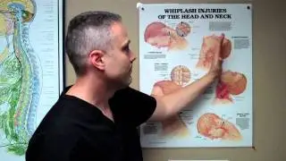 Seattle Personal Injury : Call Sarah 425-802-5432 auto accident injury doctor seattle wa