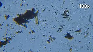 A Living Closterium Desmid (Freshwater Microscopy)