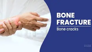 Nursing Care in Cast Application#fracturemanagement#Aiims_Nursing#norcetexam#ajaysaini7348#youtubevd