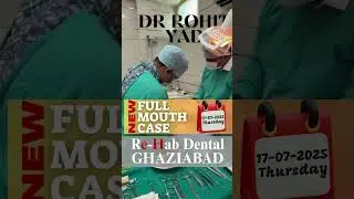 A day in the life of Dr Rohit Yadav- full mouth implants, follow-ups!