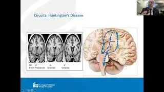 HDSA & ME: Psychiatric Symptom Management