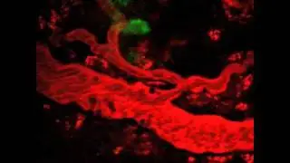 #NIDCR: Vascular Flow Close to a Lymph Node in a Live Mouse Harboring a Metastatic Tumor
