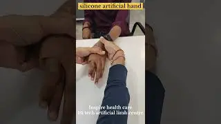 Best quality Silicone Artificial hand 🖐️ at Inspire health care, Hi tech artificial limb centre