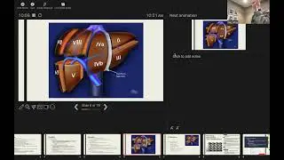 Hepatobiliary ABSITE Review
