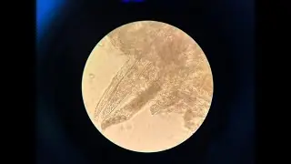 Demodex folliculorum
