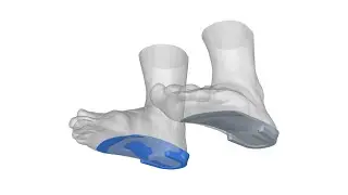 LeoInsole Workflow: Streamline Custom Insole Design