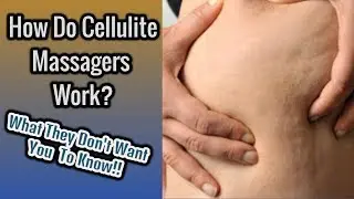 How Do Cellulite Massagers Work