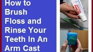 How to Brush, Floss and Rinse Your Teeth With An Arm Cast: Life With A Cast (Broken Arm) Episode 9